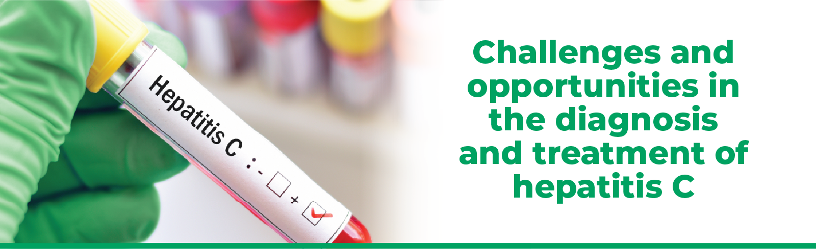 Banner Challenges and opportunities in the diagnosis and treatment of hepatitis C
